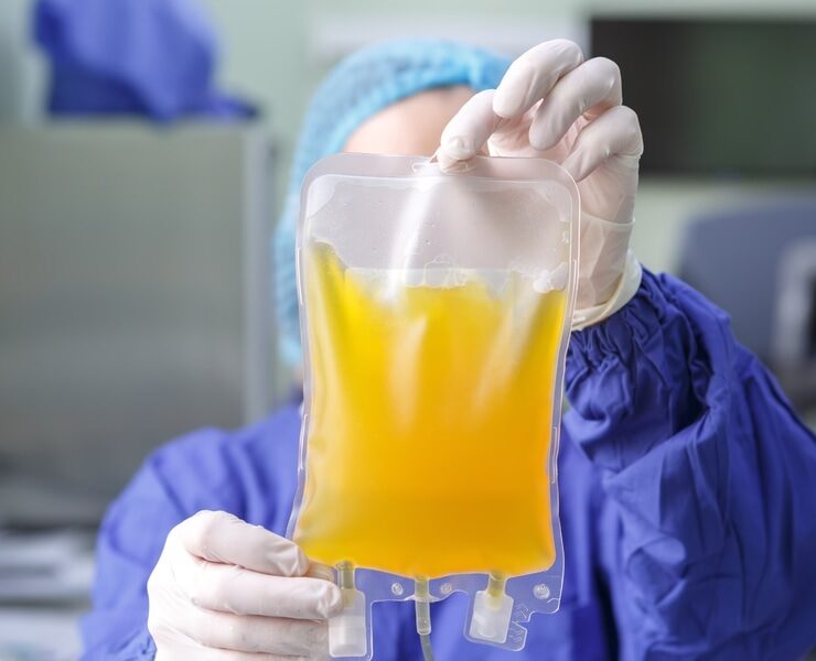 Plasma: i dati di ottobre 2021